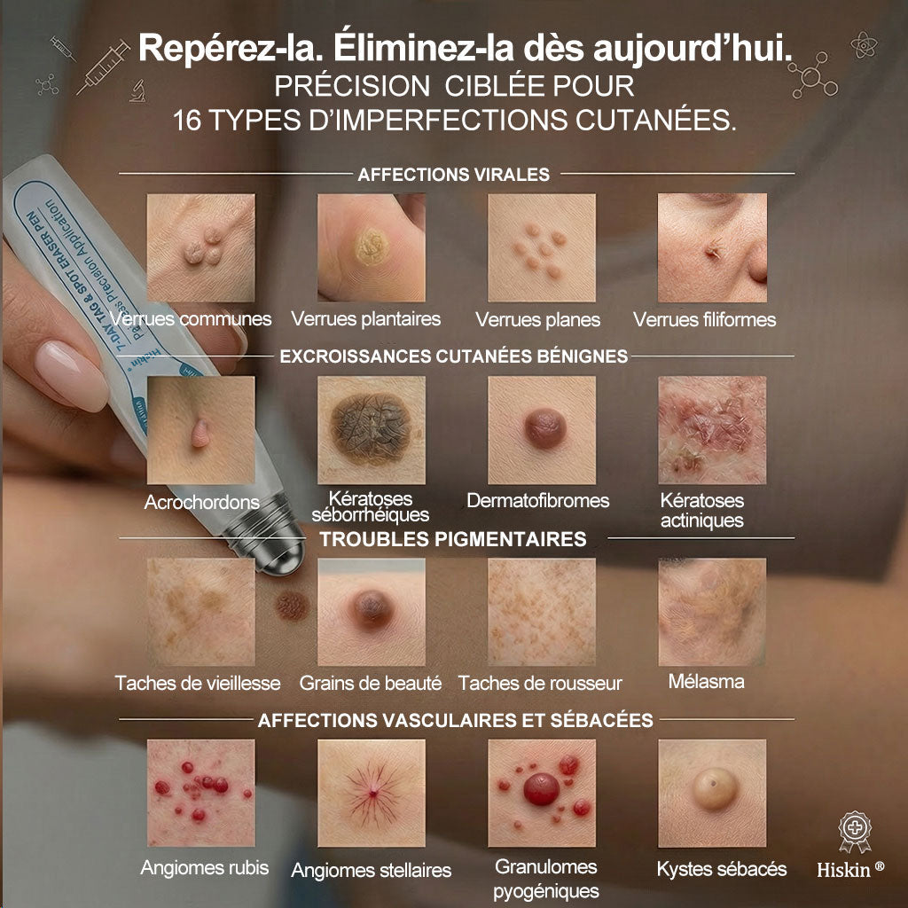𝐁𝐨𝐮𝐭𝐢𝐪𝐮𝐞 𝐨𝐟𝐟𝐢𝐜𝐢𝐞𝐥𝐥𝐞 𝐝𝐞 𝐥𝐚 𝐦𝐚𝐫𝐪𝐮𝐞 | ✅💎 Hiskin® Effaceur Acrochordons & Taches 7 Jours（applicateur à bille, sans douleur et sans cicatrice）