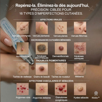 𝐁𝐨𝐮𝐭𝐢𝐪𝐮𝐞 𝐨𝐟𝐟𝐢𝐜𝐢𝐞𝐥𝐥𝐞 𝐝𝐞 𝐥𝐚 𝐦𝐚𝐫𝐪𝐮𝐞 | ✅💎 Hiskin® Effaceur Acrochordons & Taches 7 Jours（applicateur à bille, sans douleur et sans cicatrice）
